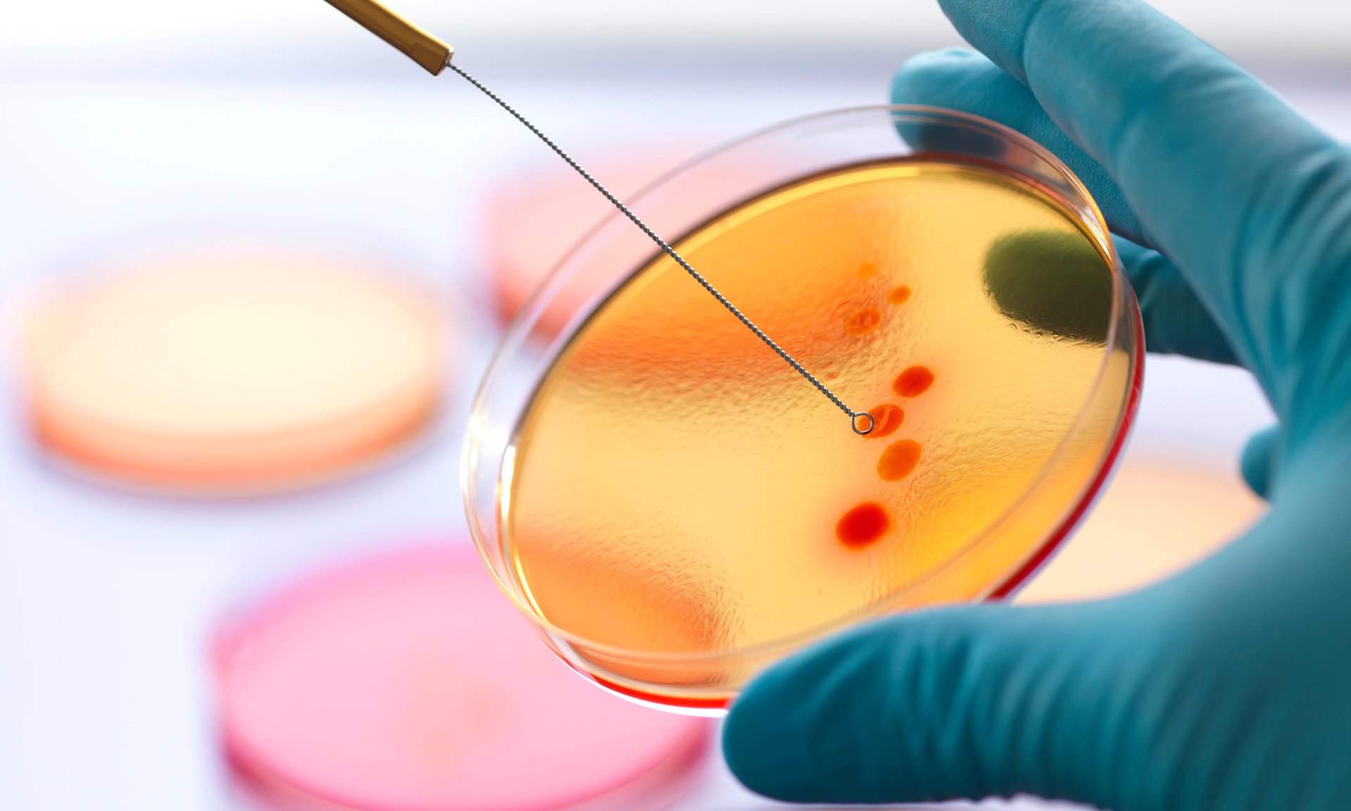 Can open data help curtail the spread of antibiotic resistant bacteria? Photograph: Alamy